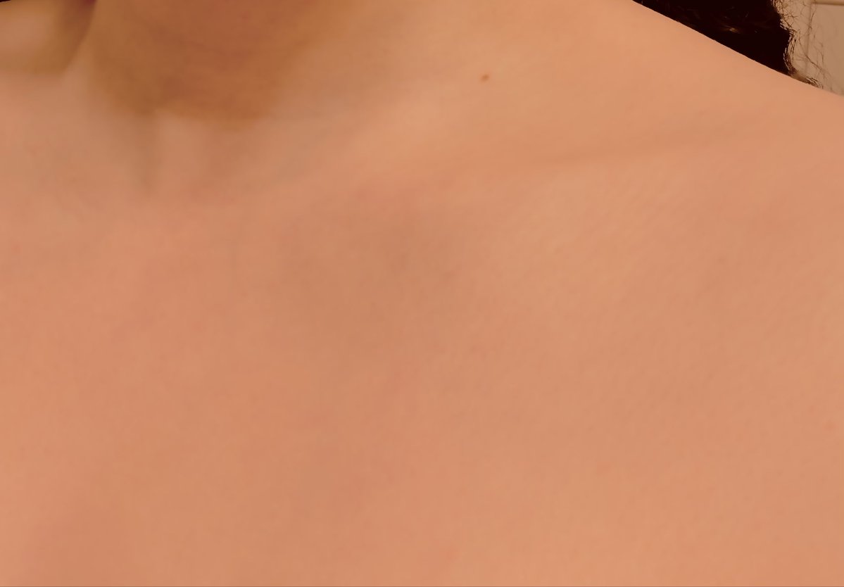 moonlitseaya's tweet photo. lil bby collarbone, i see you 🥰 i want to see more of you 🥰
BMI 20.8 124 lbs 🌙 for my progress diary
let's lock in moots 💋

#edrtwtㅤ #edtwtt https://t.co/9XyMzb9efc