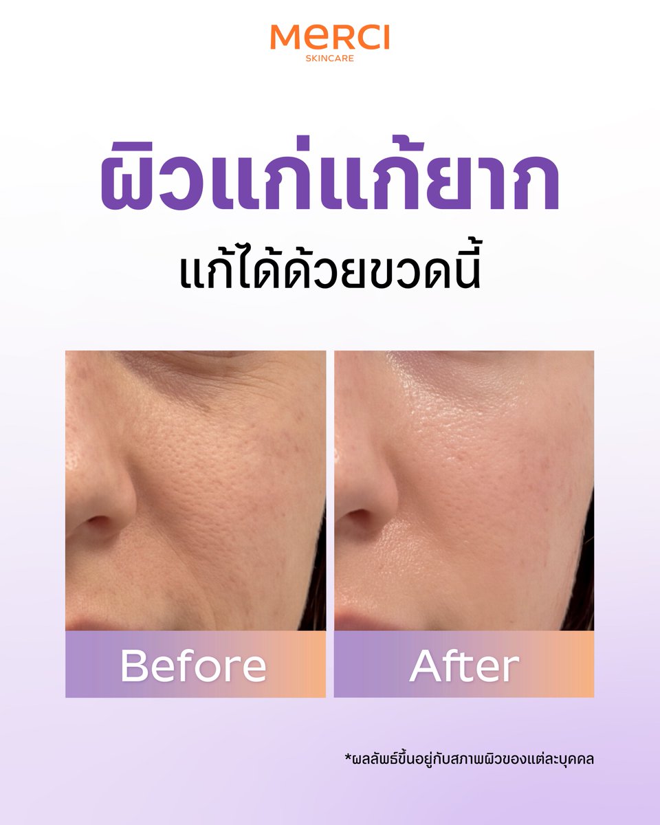 merci_skincare tweet picture