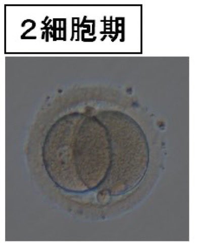 toyosensei369's tweet photo. Vesica Piscis（ヴェシカパイシス）
と呼ばれる二つの円が重なる幾何学。

古くからそれは
「生」や「女性性」の象徴とされてきました。

受精後、最初の分裂���現れる2細胞期。

ひとつがふたつに分かれ、
その重なりの中に、次の生命の設計が宿る。

生命は秩序の上に始まる。 https://t.co/9idVWXYjQ8