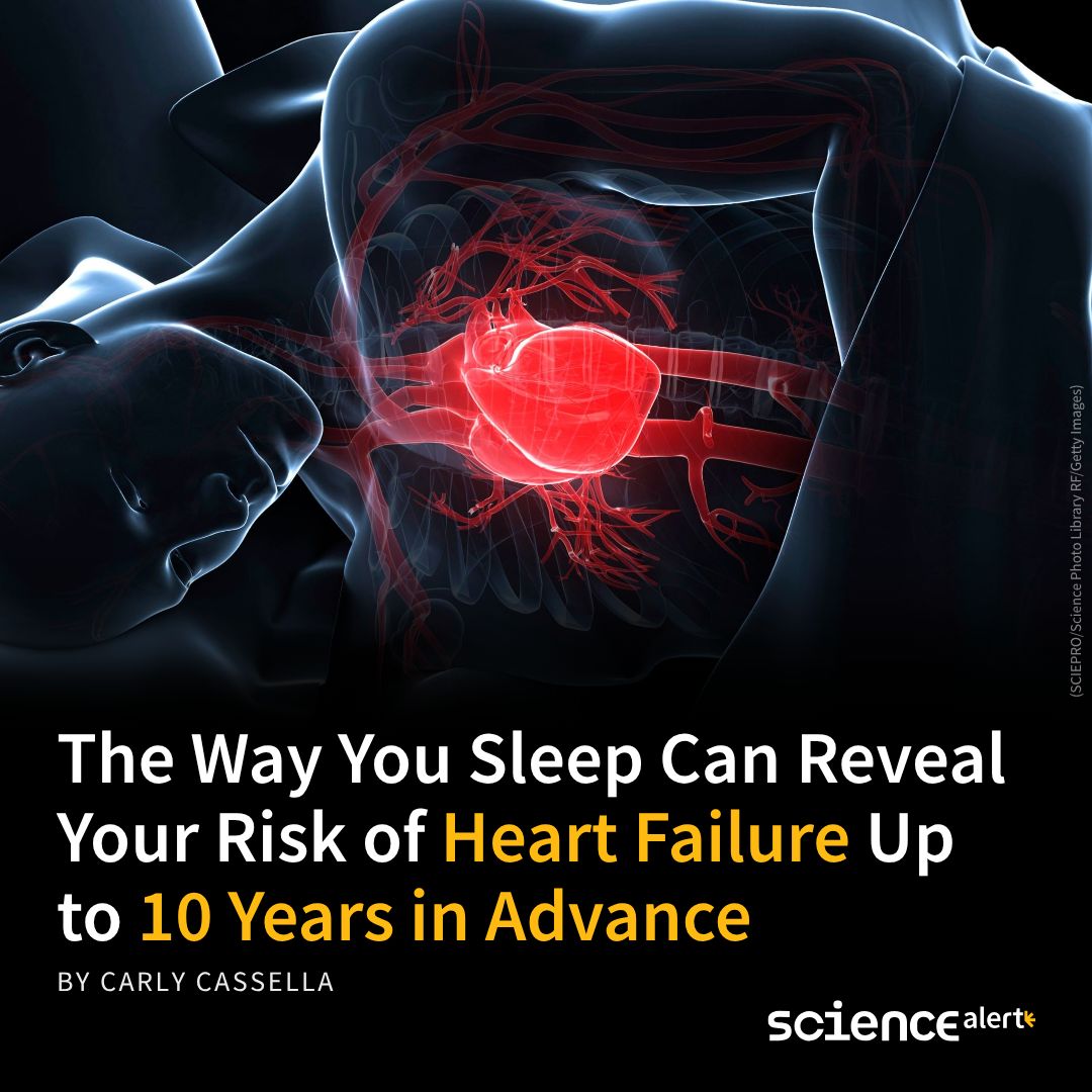 ScienceAlert's tweet photo. One night of sleep. One ECG lead. AI trained on 16,000 patients found heart failure risk up to 133 percent higher in those whose hearts showed subtle shifts during the lightest sleep stage. 🔗 https://t.co/pVQSp4jT1g https://t.co/ibovFIJIwz