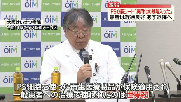 livedoornews's tweet photo. 【経過順調】iPS細胞・心筋シート「実用化の段階入った」執刀医と患者が会見
https://t.co/AhfDsPqjfD

先月29日に手術を施行。iPS細胞を使った再生医療製品が保険適用されて、一般の患者への治療で使われたのは世界初。女性は術後の経過も順調で、すでに歩くこともでき、明日22日退院予定だという。 https://t.co/HeCMIZwXPh
