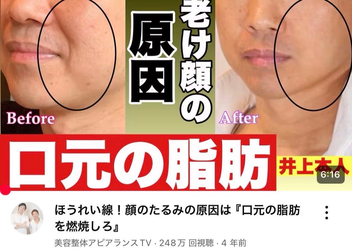 kire_na_re's tweet photo. 口元のもたつきが落とせば人間、こんなにも若返って見えます。いつもの5倍垢抜ける、、 https://t.co/kjj5tAdTJl