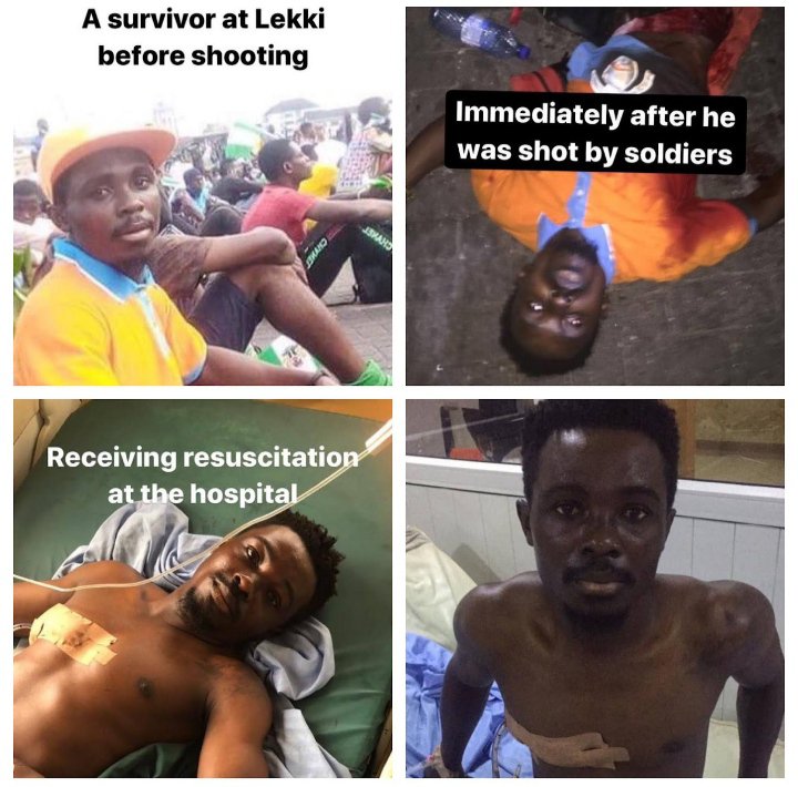 ComedyStone's tweet photo. @ifesalakooffice I was one of them who was shot at Lekkitollgate on 20-10-2020 https://t.co/ugeUtBh8PK