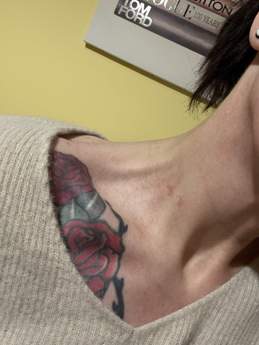 Red Rashes On Neck Woken up with two marks on my neck, almost half moon shaped with a ...