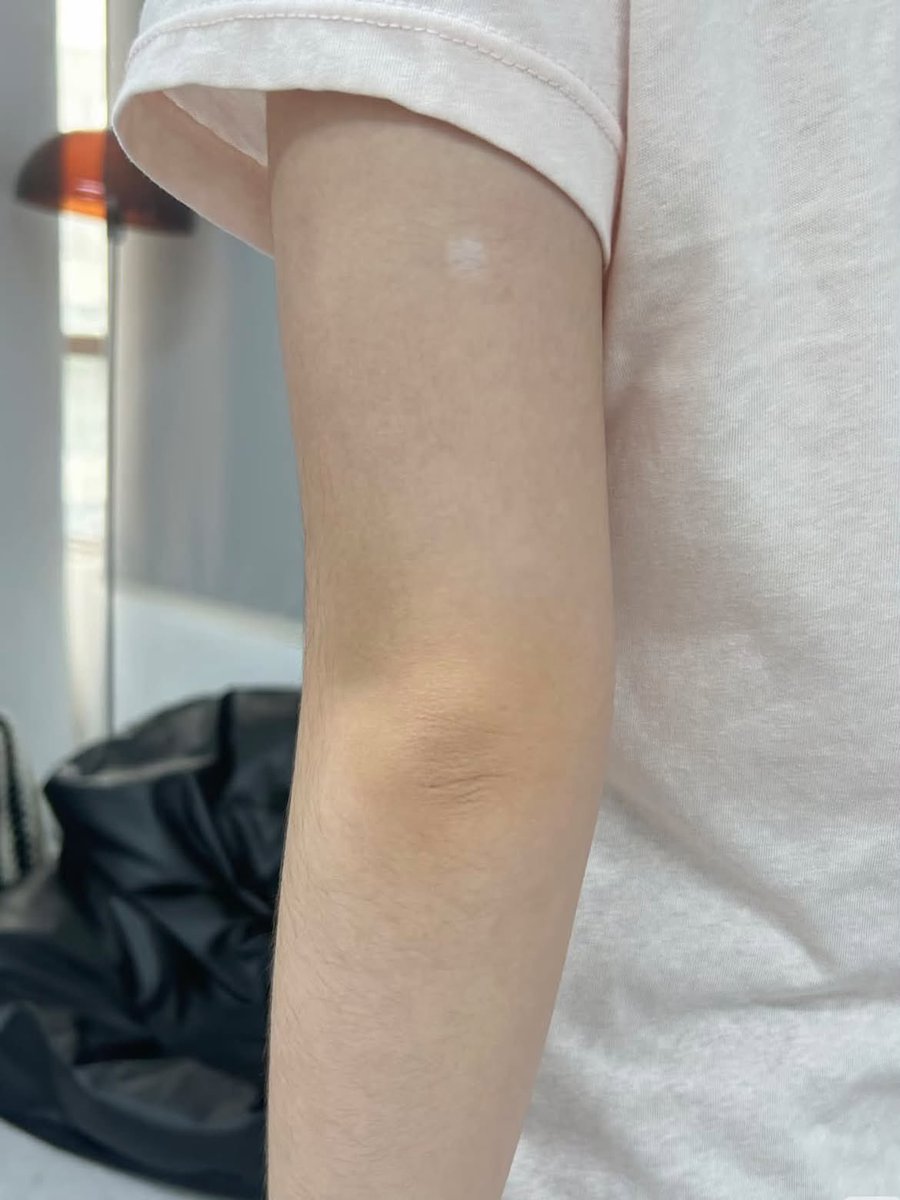 arlidaclon's tweet photo. MBAK KATINGKU demi apa KAMU BAIK BGT 😭
Aku dikasi saran klo siku atau lipatan yg hitam mau cerah dalam sebulan pake ini aja, katanya ga banyak yg tauuu..￼ https://t.co/jbhbnKhLfq