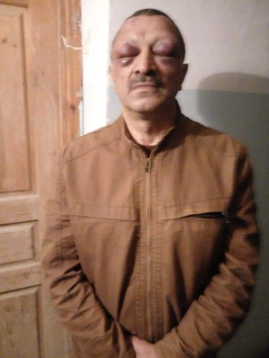 BotoxIgnesi's tweet photo. Diktatör Aliyev’in dövdürttüğü, 65 yaşındaki 1. Karabağ savaşı gazisi, muhalif politikacı Tofig Yagublu.

Kendisi yıllardır “tutuklu”. https://t.co/mL6EzZxtGV