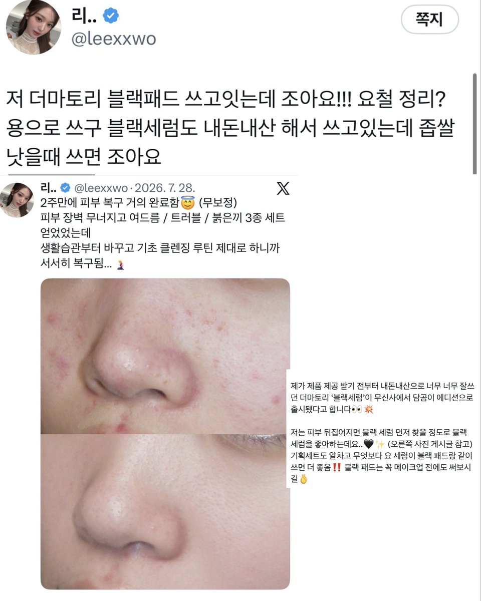 leexxwo's tweet photo. [ 광고 ] @dermatory_kr

제가 진짜x15680 여러번 언급하고 추천한 찐템✨ 

저는 피부 뒤집어진 날 더마토리 블랙 라인 필수로! 꺼내쓰거든요..✔️ 이정도로 제가 너무 애정하는 더마토리 블랙라인이, 이번에 블랙 마스크까지 추가 되어서 더 넓게 확장됐어요🖤💥

블랙 패드로 피지 / 모공 닦고 ➡️ 블랙 마스크로 열감 내리고 ➡️ 블랙 세럼으로 진정해주면 티 없이 매끈해지는 피부 루틴 끝‼️ 아니.. 요 루틴만 따라했더니 모공이랑 트러블 케어를 한 번에 해서 매끈 뽀둥 피부결 되니까 너무 좋음,,🫰

블랙 패드 좋아하시는 분들이면 블랙 마스크도 무조건 좋아하실거라고 장담합니다🙏

자세한 후기는 타래에서 설명해드릴게요🙌