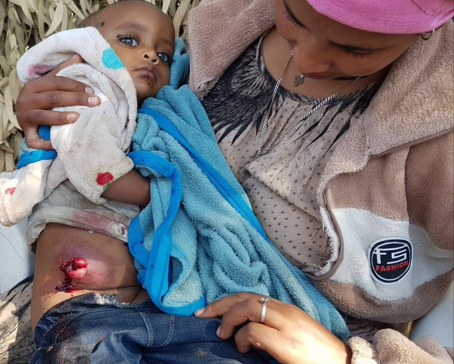kenyaaxis's tweet photo. #Ethiopian military drone and artillery strikes in Shewa, #Amhara Region, reportedly killed four civilians, including three-year-old Mita Endalen, and injured more than 15 others.

Residential areas, schools and farmland were hit during the October 21 attacks. https://t.co/rCoiEgwUqw