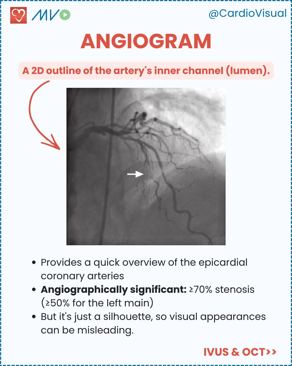 CardioVisualApp's tweet photo. A simple guide to anatomy vs physiology, angiogram and IVUS/OCT vs FFR/iFR, CT-FFR and what each one tells you.

Learn more about diagnostics of cardiovascular dieases only on the Clinician Hub! Visit https://t.co/ju8HkHJWL9! https://t.co/T9qhGk4nc0