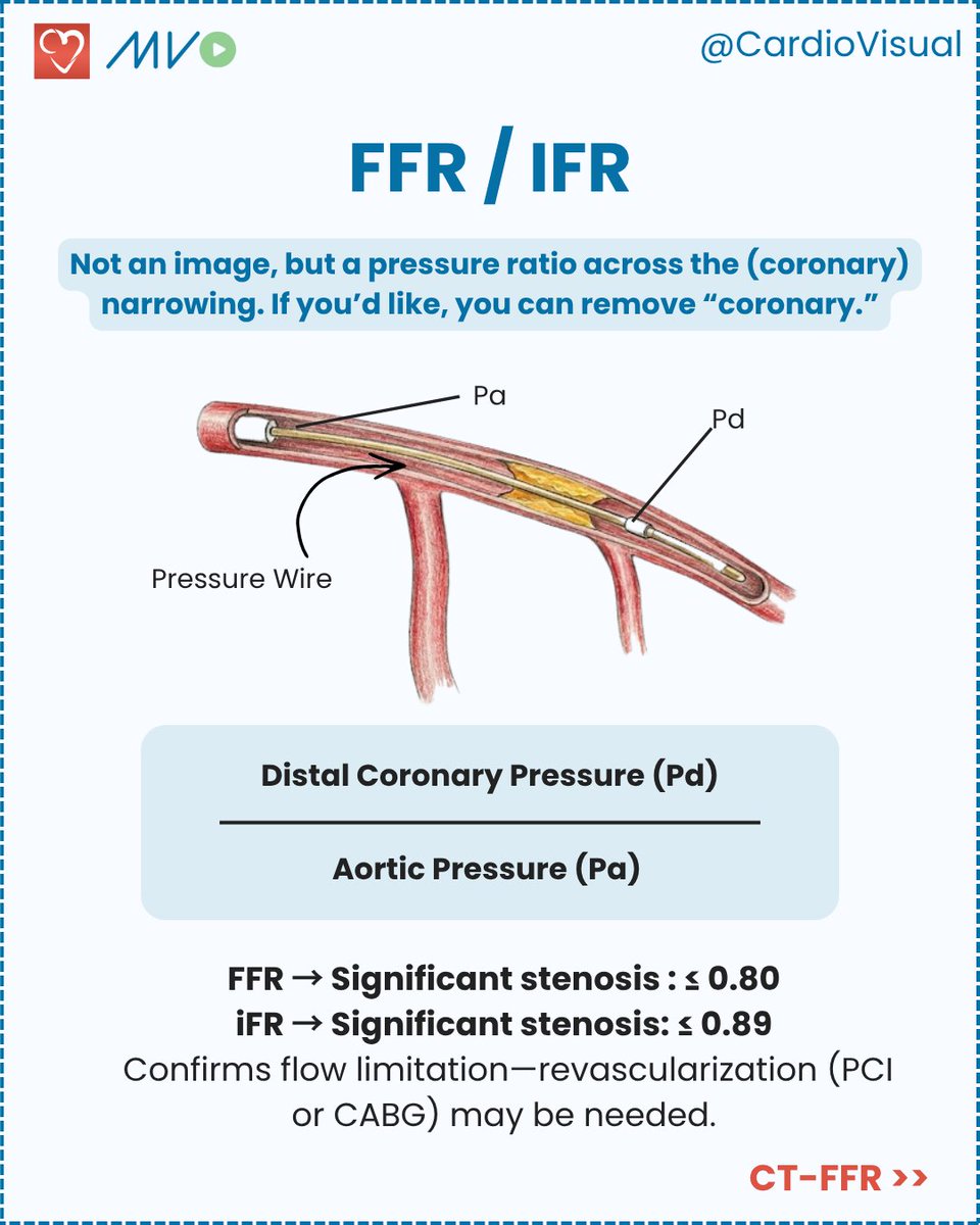 CardioVisualApp's tweet photo. A simple guide to anatomy vs physiology, angiogram and IVUS/OCT vs FFR/iFR, CT-FFR and what each one tells you.

Learn more about diagnostics of cardiovascular dieases only on the Clinician Hub! Visit https://t.co/ju8HkHJWL9! https://t.co/T9qhGk4nc0