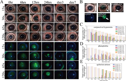 ARVOiovs's tweet photo. Luguang Jiao et al. from the Academy of Military Medical Sciences, Beijing systematically characterize the dynamic progression of corneal injury and the subsequent repair following suprathreshold exposure to 254-nm UV-C radiation.
https://t.co/JeIUdo5fM3 https://t.co/KXTeSApOor