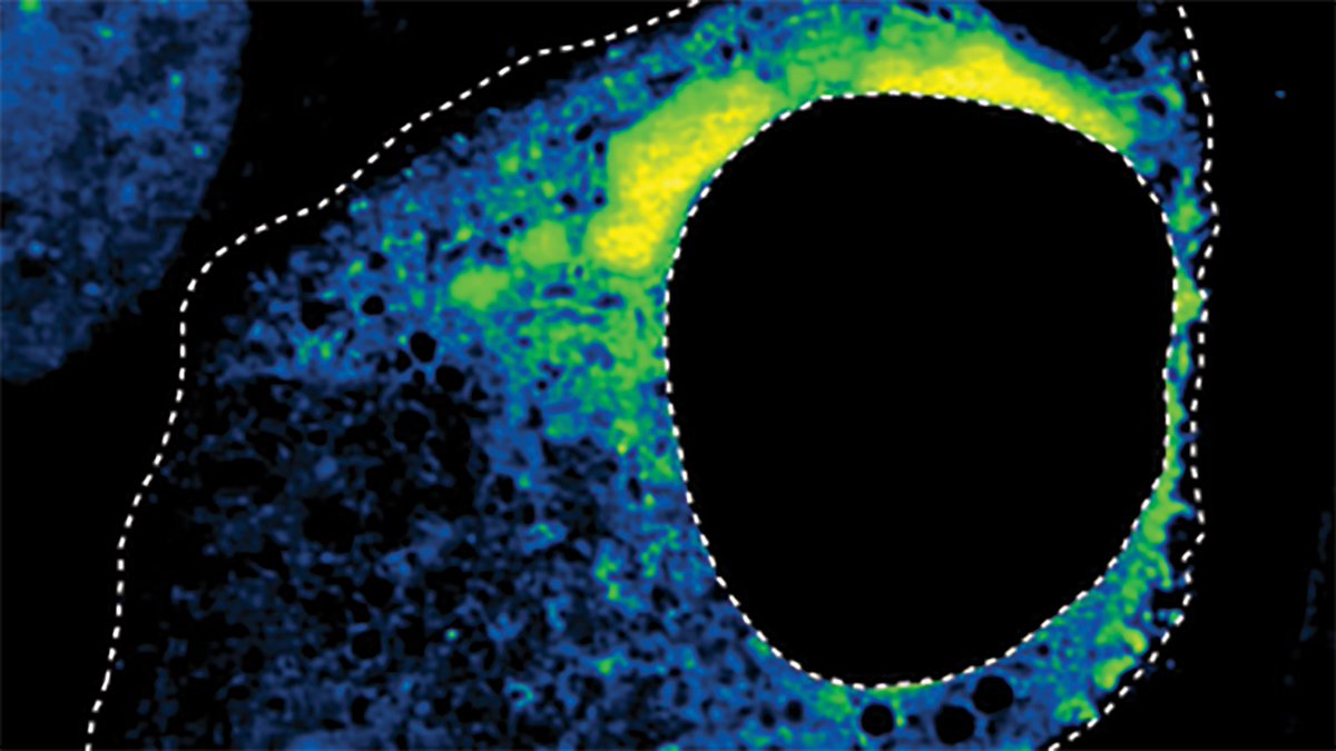 Princeton's tweet photo. Researchers at Princeton University have harnessed AI to understand how drugs affect the dynamics of vital structures within the cell, introducing a tool that can map the shape of these structures to functional outcomes and shed light on important markers of health.

To do this, a team led by @brangwynnelab examined the shape changes of biomolecular condensates, tiny droplets in living cells that drive transcription and other gene regulation processes and have been linked to diseases including Alzheimer’s, ALS and cancer.

Read the full story: https://t.co/1qlFsVXjcU
