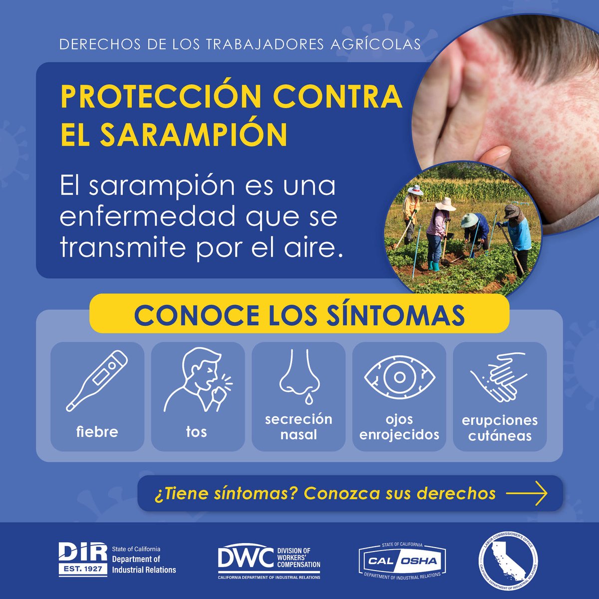 CA_DIR's tweet photo. DIR ofrece información y recursos para proteger a los trabajadores agrícolas de la propagación del sarampión.

Para programar una cita de vacunación, visite https://t.co/0OkDwMtj49

Obtenga más información:
https://t.co/1kB4mGkCW4 https://t.co/gcHp0OYC3n