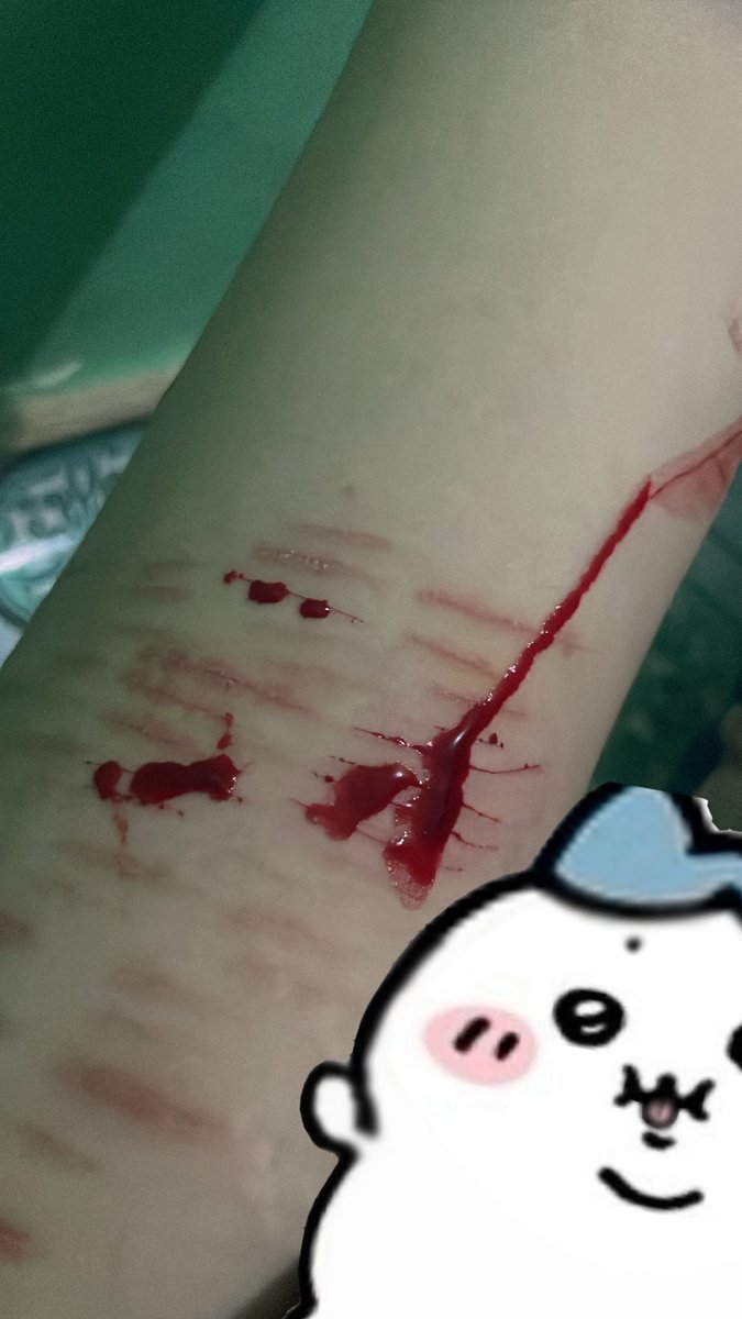 wakeupkie_o's tweet photo. #fakeblood again. https://t.co/Z44SfSyRja