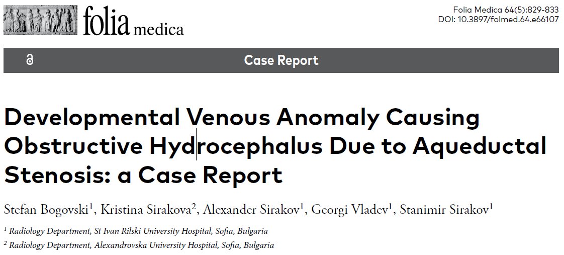 DocNavarrow's tweet photo. ✅Obstructive hydrocephalus due to aqueductal compression by a developmental venous anomaly (DVA).

💡Mesencephalic DVAs can rarely cause aqueductal stenosis. Radially converging medullary veins and a collector draining into the vein of Galen support the diagnosis.

https://t.co/JOd0bMliDG