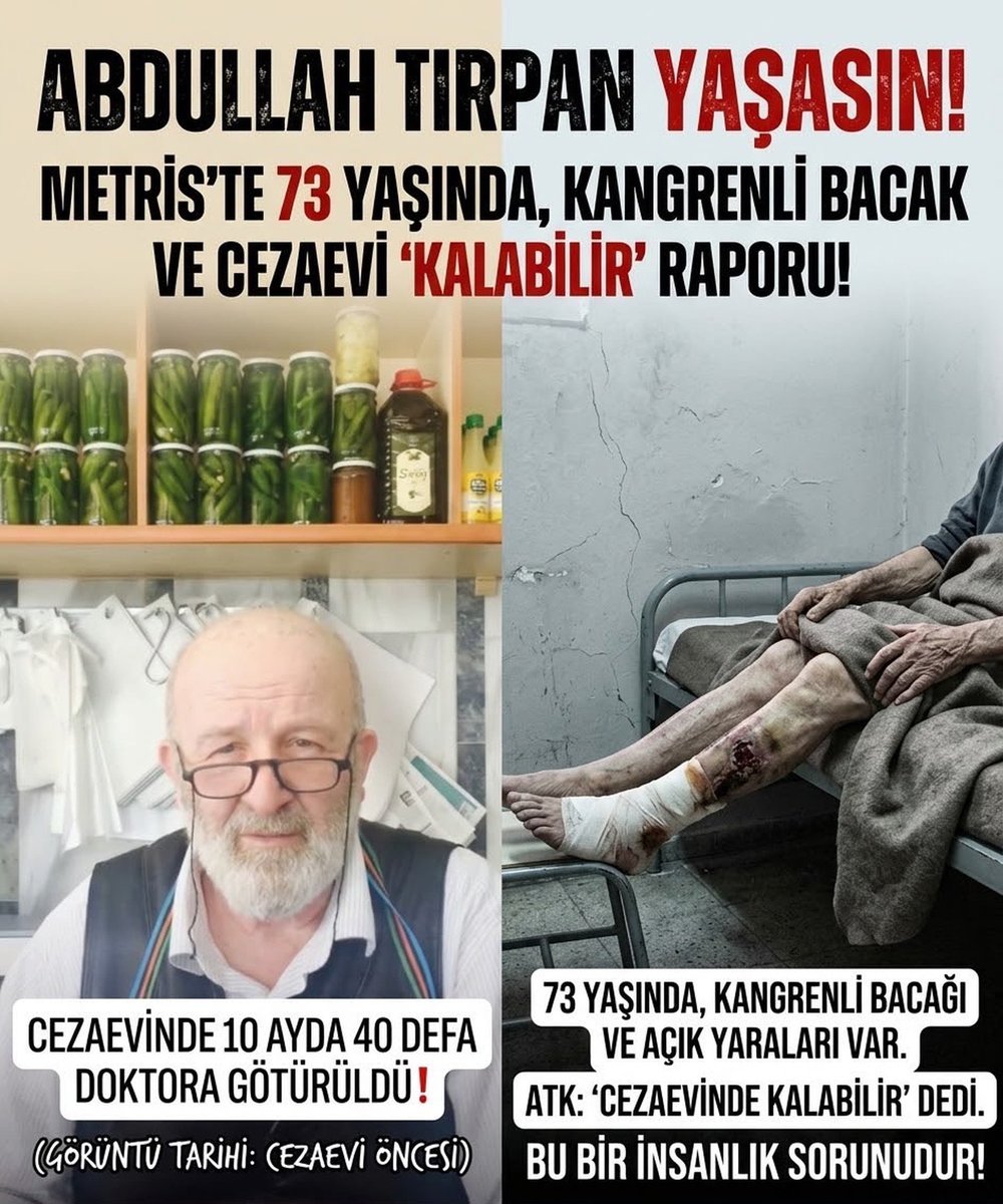 Hakk_Yolu27's tweet photo. 🩸💔 KANGREN SARDI, ŞU AN O BACAĞI KESİLİYOR! 💔🩸
​🦼 73 yaşındaki Abdullah Dede’nin bacağı çürüdü, göz göre göre ampute ediliyor!
  
​😭🚨 BU BİR İNSANLIK SUÇUDUR, YAYIN!
​⚡️⚖️ AbdullahDede İçinYaz ⚖️⚡️ https://t.co/HRPGRElEfB