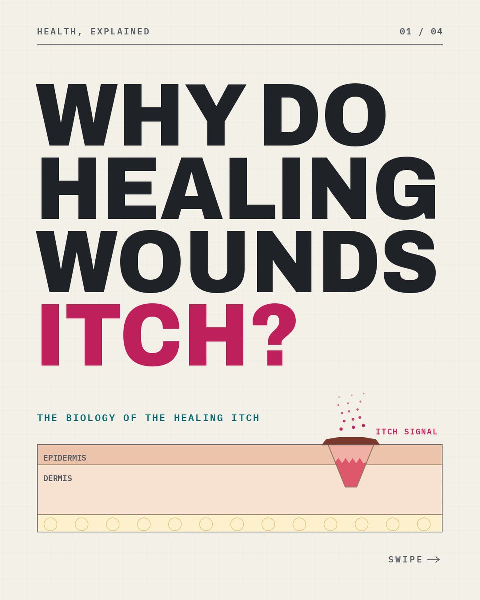 NursePrecious_'s tweet photo. Ever wondered why healing cuts itch? 🤔🩹
​It's a natural part of healing—but when should you be concerned?
​Swipe to learn the science behind wound itching &amp; warning signs you shouldn't ignore! 🧵
  
​#WoundCare #HealthTips #NursingStudent https://t.co/c9ufg5WUkT