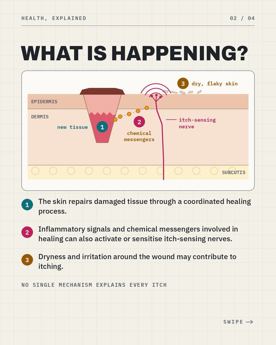 NursePrecious_'s tweet photo. Ever wondered why healing cuts itch? 🤔🩹
​It's a natural part of healing—but when should you be concerned?
​Swipe to learn the science behind wound itching &amp; warning signs you shouldn't ignore! 🧵
  
​#WoundCare #HealthTips #NursingStudent https://t.co/c9ufg5WUkT