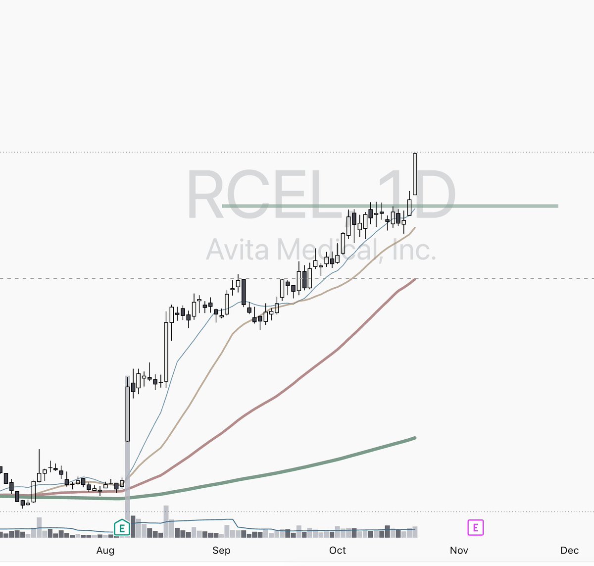 KaiMomentum's tweet photo. $RCEL $LIFE 漂亮形态，昨天进入后今天分别+11% &amp; 8.2%，虽然最近很多热门AI硬件跌了很多让人很想抄底，但是跟随强势还是来得更直接一点 https://t.co/r82U1NZGCm