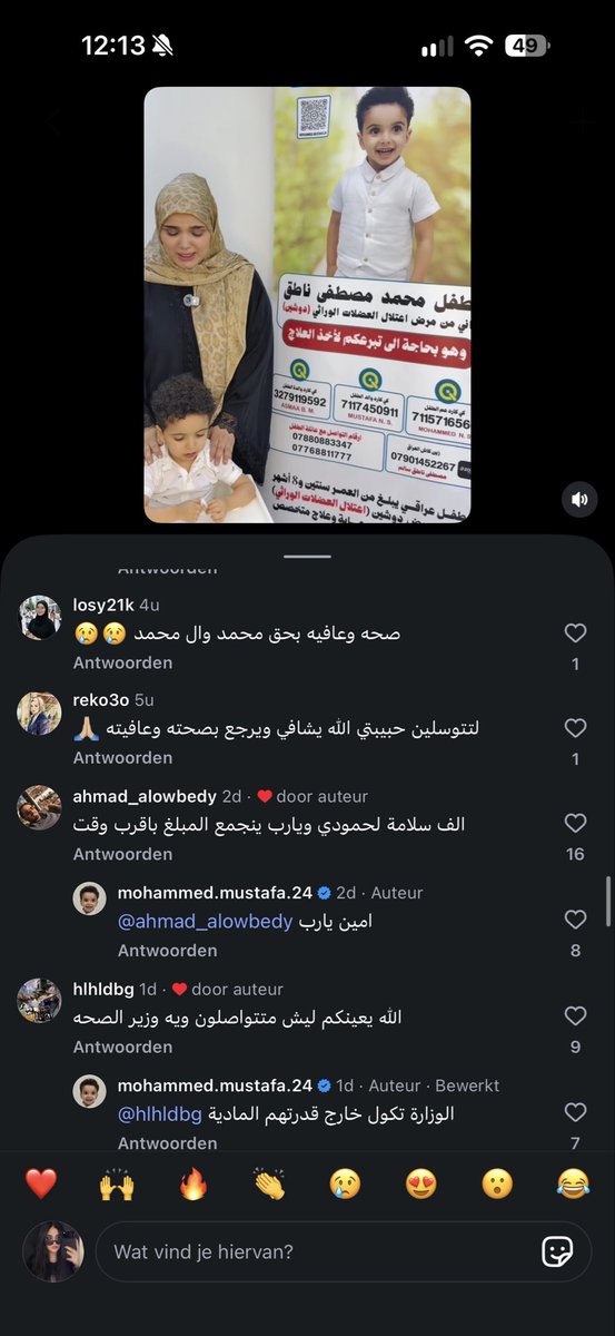 DIlIlBI's tweet photo. هذا الطفل محمد مصطفى مصاب بمرض اعتلال العضلات (دوشين)
 ويحتاج ابره بعد سنه وسعرها يكلف3ملايين دولار ومتوفره بدول محددة
الي يكدر يتبرع لايقصر حتى اذا مبلغ بسيط وشاركو موضوعه شكد ماتكدرون عسى ولعل تنجمع التبرعات لهذا الطفل المسكين https://t.co/lYxPESgIvi