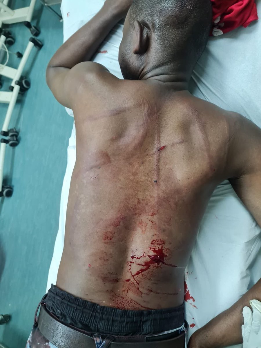 ZizinjaAbelungu's tweet photo. Assaulting and killing someone simply because they are a foreigner? What have we become people of South Africa? 🤦🏾‍♂️💔

How are we any different from those who brutally murdered our people during Apartheid if we, too, are going to behave in such barbaric and inhuman manner 💔💔💔💔💔💔😭😭😭😭