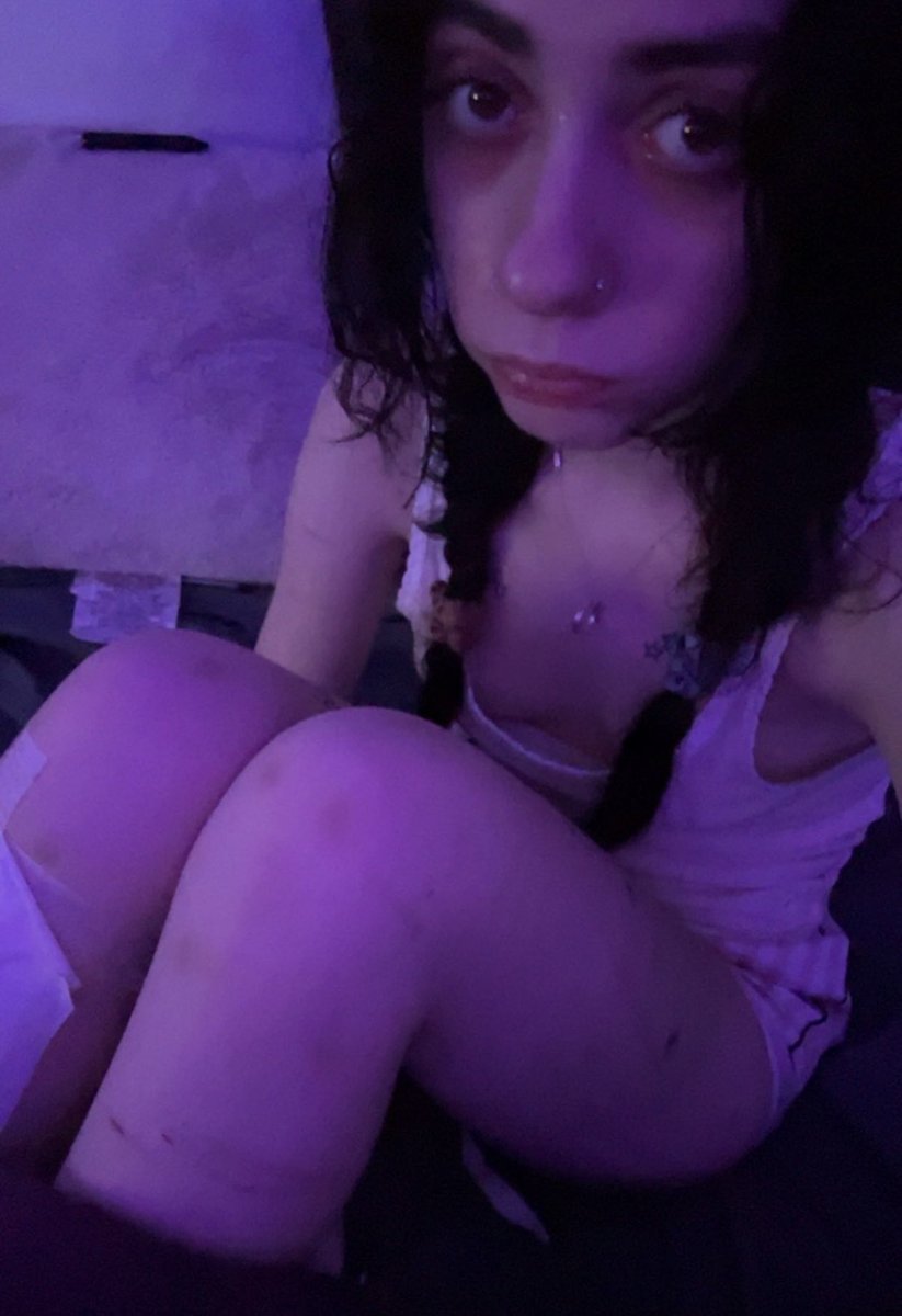 pizzieee3's tweet photo. real me #moothunt #drugtwt #drugstwt #edrtwt #shedtwt #shedrtwt #shrtwt https://t.co/gp0UuyL7zR
