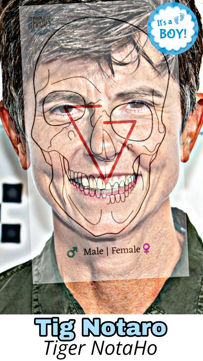 Brian_Awakened1's tweet photo. Just look at "her" neck - puts mine to shame 😂 His plastic surgeon needs FIRING! another crypto gay man pretending to be a lesbian - Tig Notaro #egi #TigNotaro #CryptoGayMan #ItsAllOfThem https://t.co/NalFvaIAyW