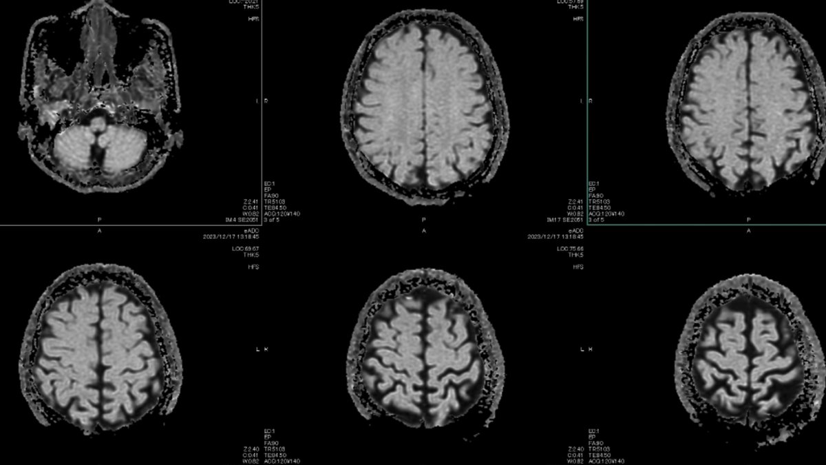 curiositydotcom's tweet photo. How do our brains process a fear response? ๐ง
Hear all about a new study on how our brain interprets threats on a new #CuriosityWeekly: https://t.co/Vcm7ARcQQF
๐ธ: Tunvarat Pruksachat
#fear #brain #neuro #Halloween https://t.co/ktfa2aPwUS