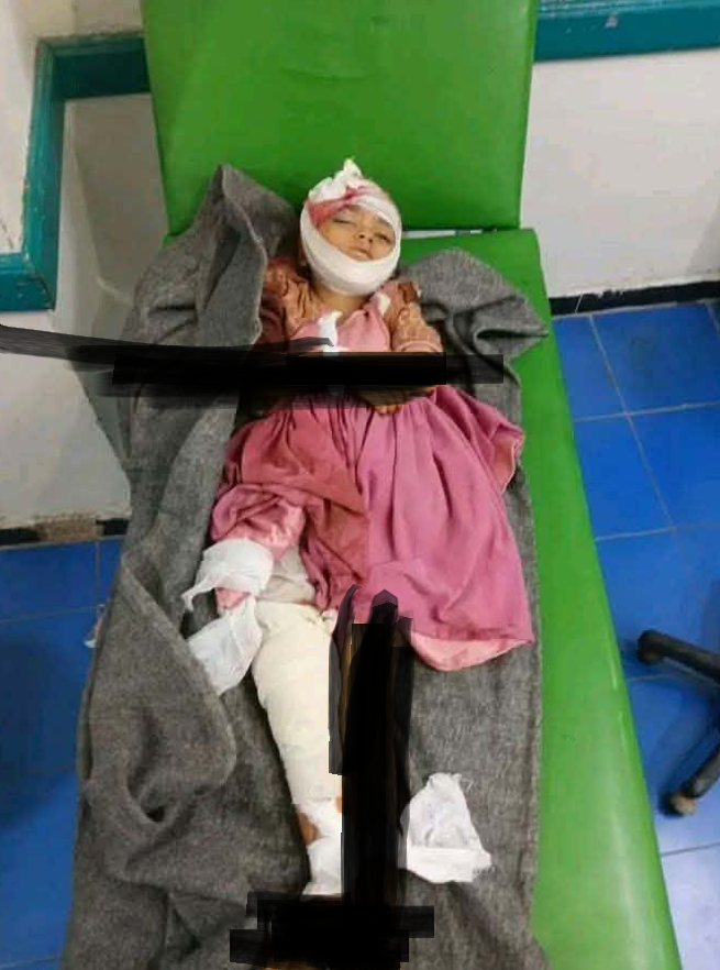 FaresALhemyari's tweet photo. Taiz, Jemen

Dit is Maya Maher Al-Kahlani. Ze raakte gewond en bleef bloeden totdat ze overleed, nadat bij haar een operatie zonder verdoving was uitgevoerd in een gezondheidscentrum in het gebied Kahlān. Het centrum beschikt niet over voldoende medische benodigdheden en het gebied wordt belegerd door de Houthi’s.

De Houthi’s hebben de afgelopen uren hun beschietingen op de dorpen Al-Shaqb, Kahlān en Al-Najādah in het district Saber opgevoerd. Daarbij zijn twee kinderen om het leven gekomen en raakten meerdere inwoners gewond.

Tegelijkertijd verscherpen de Houthi’s de belegering van de dorpen en beschieten ze elke vorm van beweging, waaronder pogingen om gewonden naar buiten de dorpen te vervoeren. De inwoners kampen met een ernstig tekort aan medische benodigdheden, waardoor artsen genoodzaakt zijn operaties uit te voeren zonder verdoving.

#Jemen
@NOS @RTLnieuws @RTL_com @volkskrant