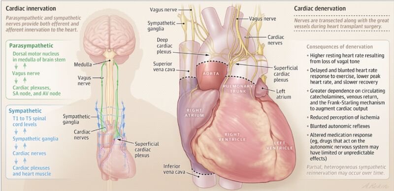 hfcollaboratory's tweet photo. Out now in @JAMANetwork from #HFC member @LindenfeldJoann et al.

This article reviews heart transplantation in advanced heart failure, with a focus on the I NEED HELP tool for early referral and, lifelong multidisciplinary care after transplantation. https://t.co/ABgwUqwfiV https://t.co/fySnsmcJ71