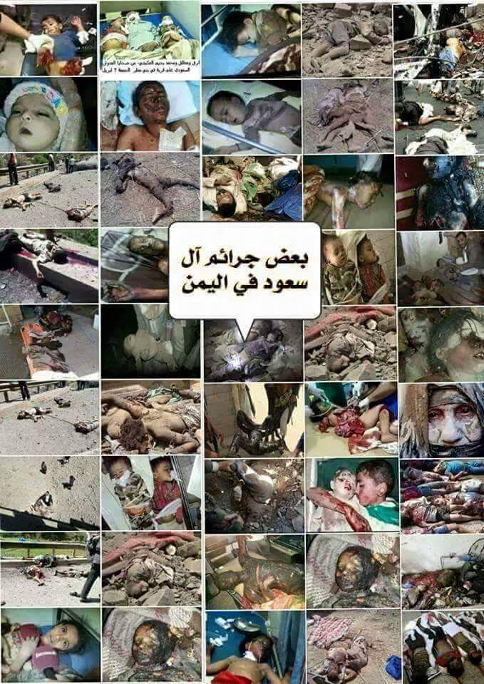 sultan770090's tweet photo. استمرار العدوان  على اليمن سيشعل النار في دول الخليج والشرق الأوسط بأكمله وبتغير معادلة المعركة ستسقط امارات وممالك وحكام ورؤساء خذلوا شعوبهم بوقوفهم مع التطبيع والمشروع الصهيوني .. اليمن تنتصر 
#الحصار_بالحصار #المطار_بالمطار
#اليمن_خط_أحمر #السعودية_قرن_الشيطان https://t.co/9C0hJ3hX4W