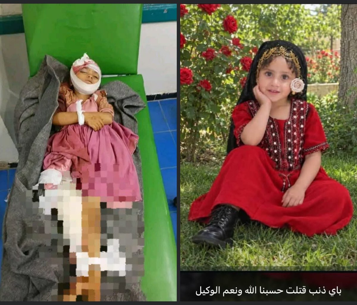 Aya1Khaled's tweet photo. مايا الكحلاني طفلة في أحد أرياف تعز  اليمنية أزهقت روحها اليوم مليشيا الحوثي الإرهابية من خلال الاستهداف للمنازل والمدنيين.. وحسبنا الله ونعم الوكيل
#Taiz
#مليشيا_الحوثي_تقتل_وتحاصر_تعز 
#فجرـاليمن https://t.co/fPzZeDniDf
