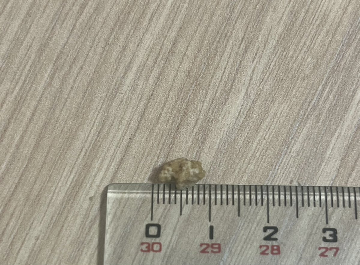 ytktci's tweet photo. 朝からとんでもねえもの出てきた https://t.co/SoPhHS1rZT