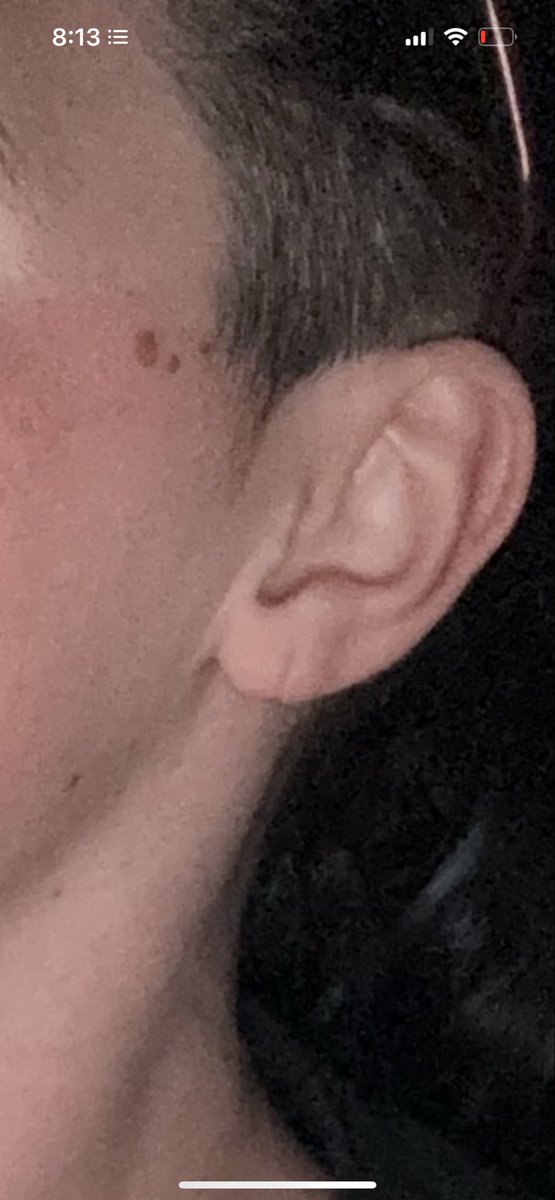 BooksColle40478's tweet photo. Why does my ear have a vagina. https://t.co/uk1P6AVaAf