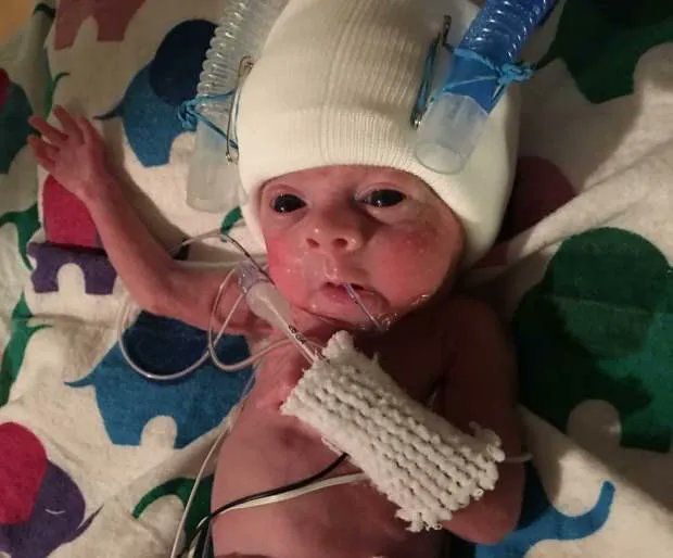 LifeNewsHQ's tweet photo. Here's a premature baby at 23 weeks.

Virginia, Idaho and Nevada want to legalize killing babies like this.

Democrats want to pass a law legalizing killing babies like this nationwide.

Vote NO. Vote pro-LIFE! https://t.co/WebAACcDRN
