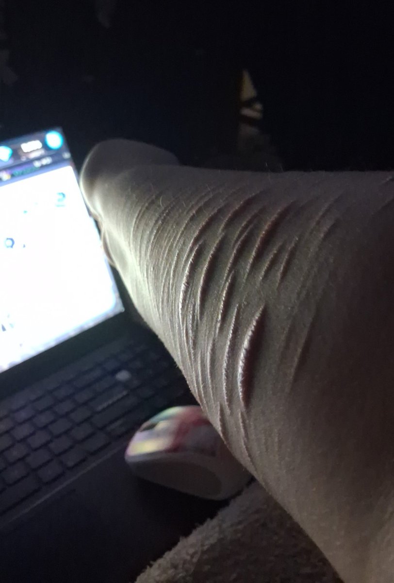 livscutz's tweet photo. Fake sfx scars 
So bumpy https://t.co/29gRNllLR6
