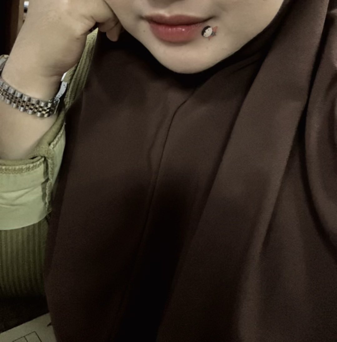 _j0y4hhh_'s tweet photo. Jerawat muncul tepi bibir lak https://t.co/AS9eMVKWEi