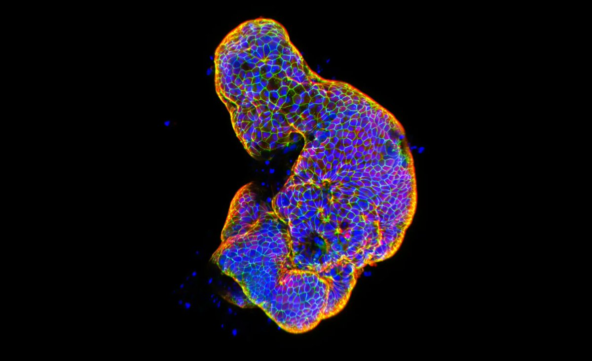 RCScience's tweet photo. "Winning entries in the 2026 Nikon Small World competitions reveal the hidden interactions that govern everyday life." via @QuantaMagazine   https://t.co/YTr7uVlR2Z https://t.co/8Zk870tnqm