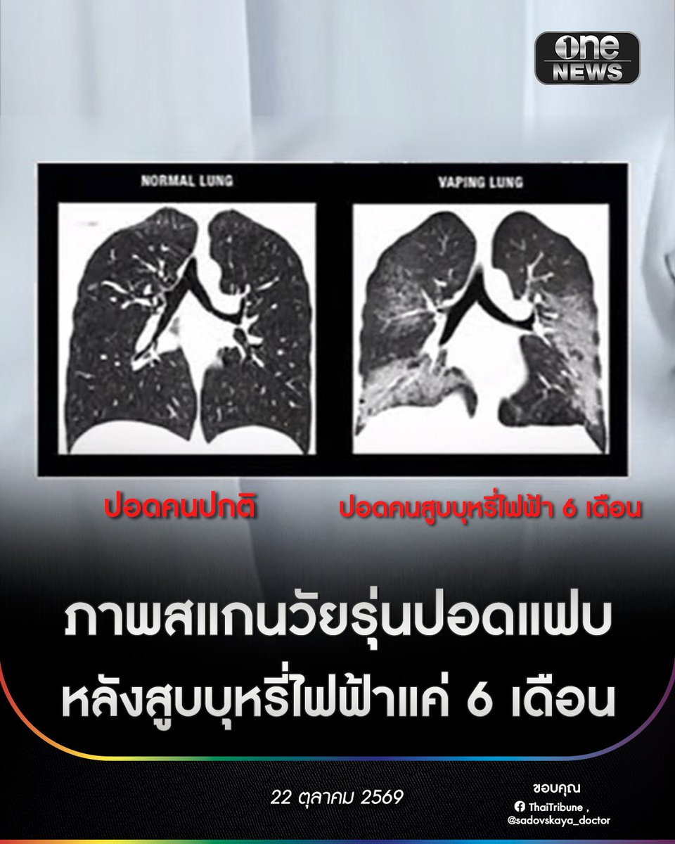 onenews31 tweet picture