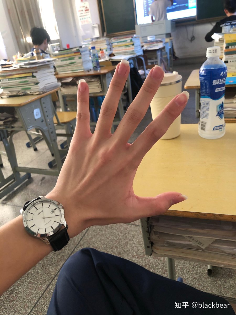 CLu1t0's tweet photo. 肿れた指で挑む年末ジョブ、導く先はどこ？徳を積む暇もなく、患部は疼き、冀うはただ平穏な日々。 https://t.co/AgB6iTVjXe