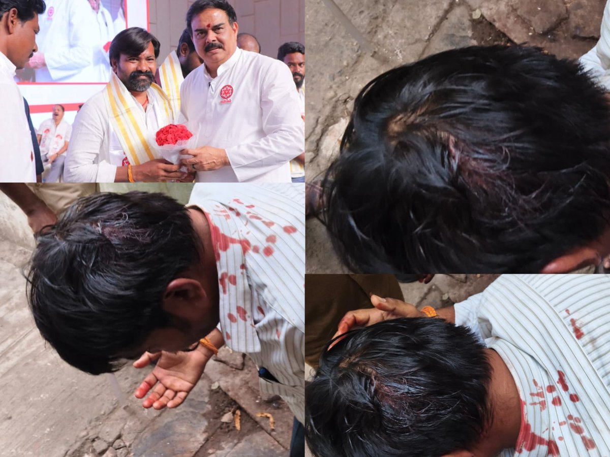 kurnool_jsp's tweet photo. జనసేన పార్టీ కోడుమూరు నియోజకవర్గ నాయకుడు దిన్నదేవరపాడు గ్రామం నుండి ఎంపీటీసీగా నామినేషన్ వేయడానికి వెళ్లి అంబేద్కర్ భవన్ నుండి బయటికి వచ్చిన చాకలి లక్ష్మన్న పై తెలుగుదేశం నాయకుల దాడి తీవ్ర గాయాలతో  కర్నూలు ప్రభుత్వ హాస్పిటల్ లో చికిత్స తీసుకుంటున్న జనసేన నాయకుడు చాకలి లక్ష్మన్న https://t.co/TSGply4N5I