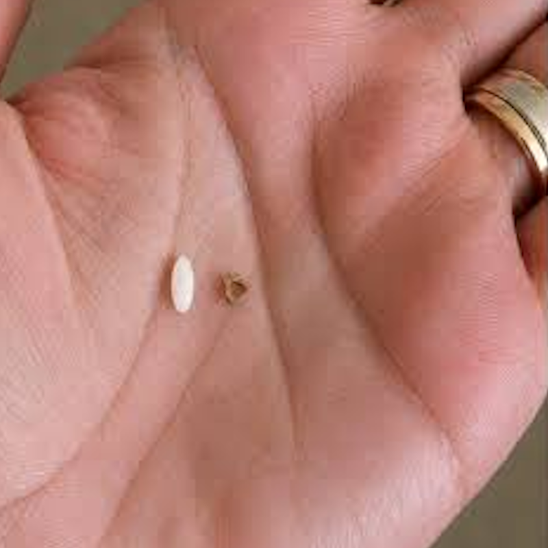 interesting_aIl's tweet photo. The smallest bone in your body is smaller than a grain of rice and sits inside your middle ear

The stapes is only about 3 millimetres long, yet it helps make hearing possible https://t.co/K6Mwf4n7jg