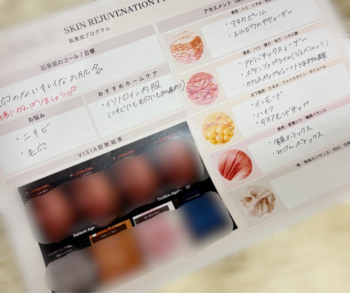 yakulto1000chan's tweet photo. こないだ行ったクリニック、VISIAのスコア紙でくれた🫪
言ってもくれないとこ多かったから嬉しい
しかもオススメ治療付きw https://t.co/Yjn3bdVJv3
