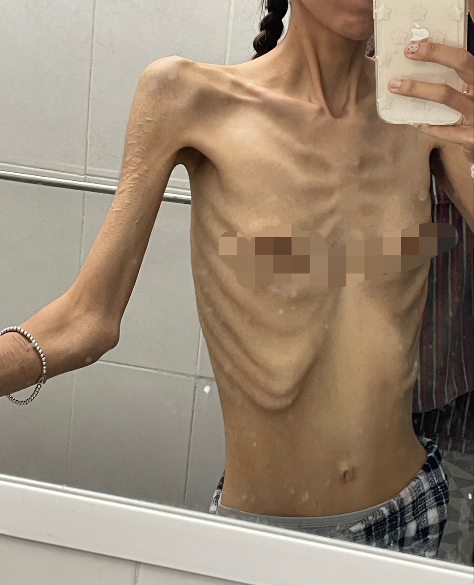 sharp_clws's tweet photo. mornin bc… mirror is so dirty lol 

been feeling so down lately, trying really hard to space out my eating windows… if I don’t eat my entire intake at once I get bloated AF :/ https://t.co/aHIaIviKQd