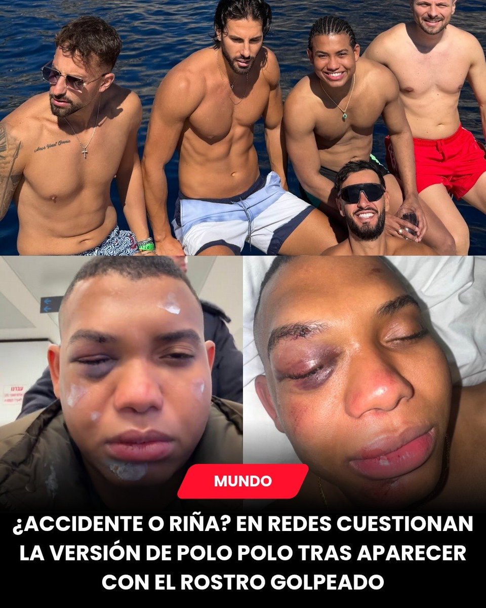 YongMauro's tweet photo. No joda Pola Pola @MiguelPoloP eso fue más que un vergazo en la cara, eso fue una masacrada!!! La vez pasada, en Europa también, en Roma creo, atracaron a la marica y le quitaron buen billete. Ahora también en Europa, le pegan qué masacrada tan hijueputa y de seguro no se lo culiaron !!! Esa marica en qué chochales se mete a buscar verga? La van a salir matando!!! Y a todas esas, de dónde saca la plata?