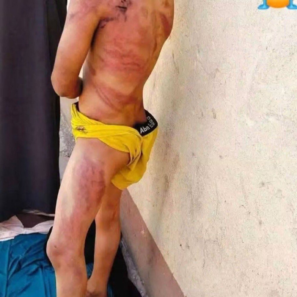 liderfiscal's tweet photo. #URGENTE Esto es una violación del derecho internacional…bajo los Artículos 76 y 143 del Cuarto Convenio de Ginebra, Pablo Lemus tiene que pagar por la tortura a los manifestantes secuestrados.

Si apoyas para que Pablo Lemus sea llevado a la @CIJ_ICJ por las violaciones en las detenciones de ciudadanos #RTMasivo

@CorteIDH @CNDH @UNHumanRights @hrw