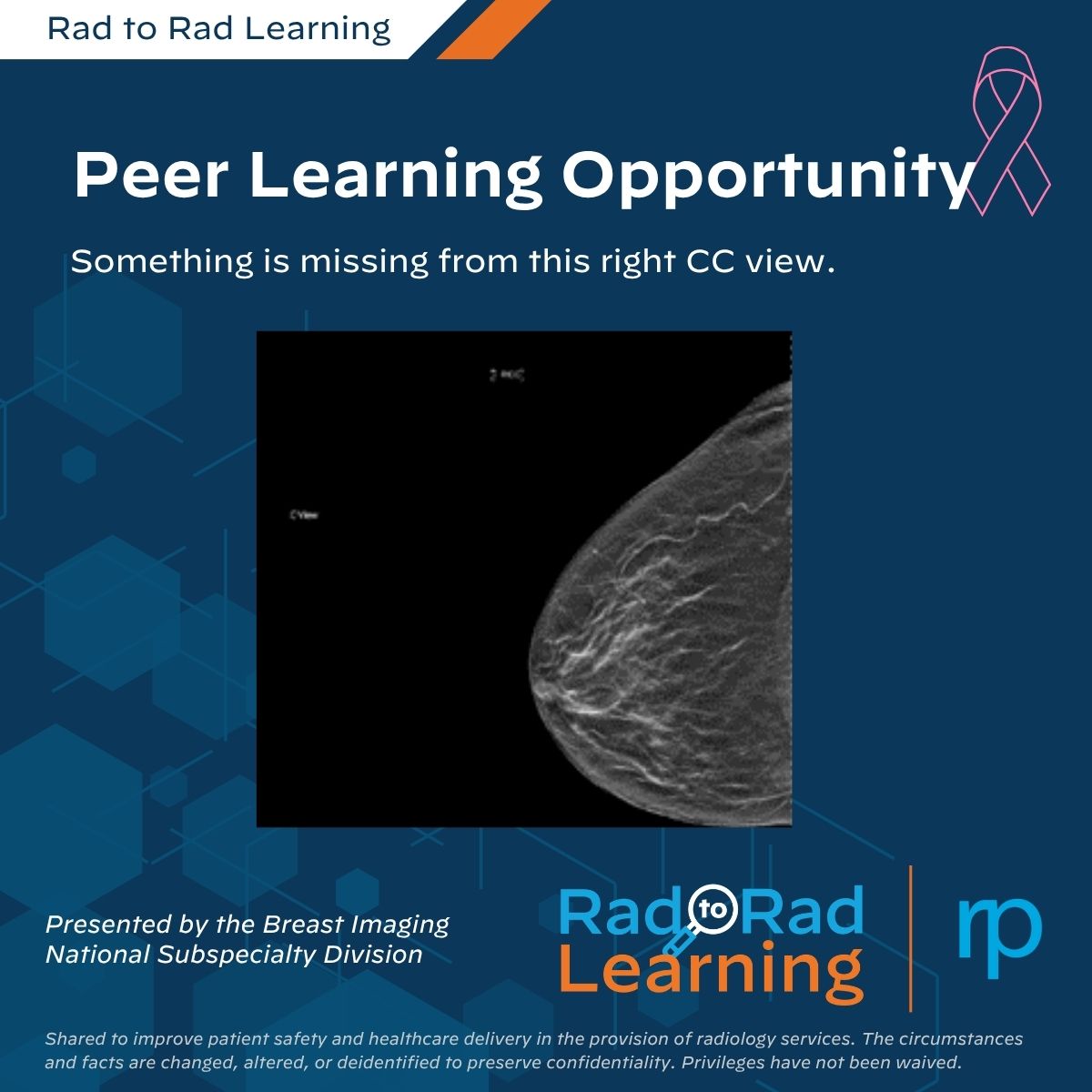 Rad_Partners's tweet photo. Small details can make a big difference in breast imaging.

Our latest #PeerLearning case highlights how proper patient positioning & imaging technique can reveal findings that might otherwise be missed.

The takeaway? You can't find cancers you can't see.

Explore the case: https://t.co/riF7O99LiH