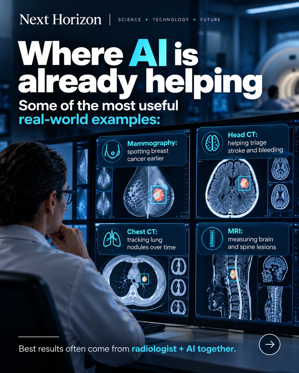 nexthorizon_s's tweet photo. AI in radiology can detect patterns in X-rays, CT and MRI scans that humans may miss — but “AI vs radiologists” is the wrong question.
The strongest results often come from AI + doctor.
https://t.co/grw4uwdUR5
#AI #Radiology #Healthcare #MedTech #Science #Imaging #Tech https://t.co/IMGQmn6ndd