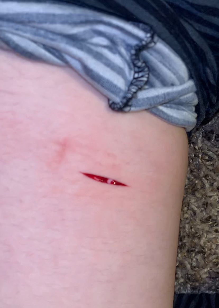 pyskropath's tweet photo. styros and a cut i didnt mean to do so deep
fake, sfx makeup, made with ai

#shhtwt #slittwt #seshtwt #ouchietwt #988twt https://t.co/gB6nnoKDS5
