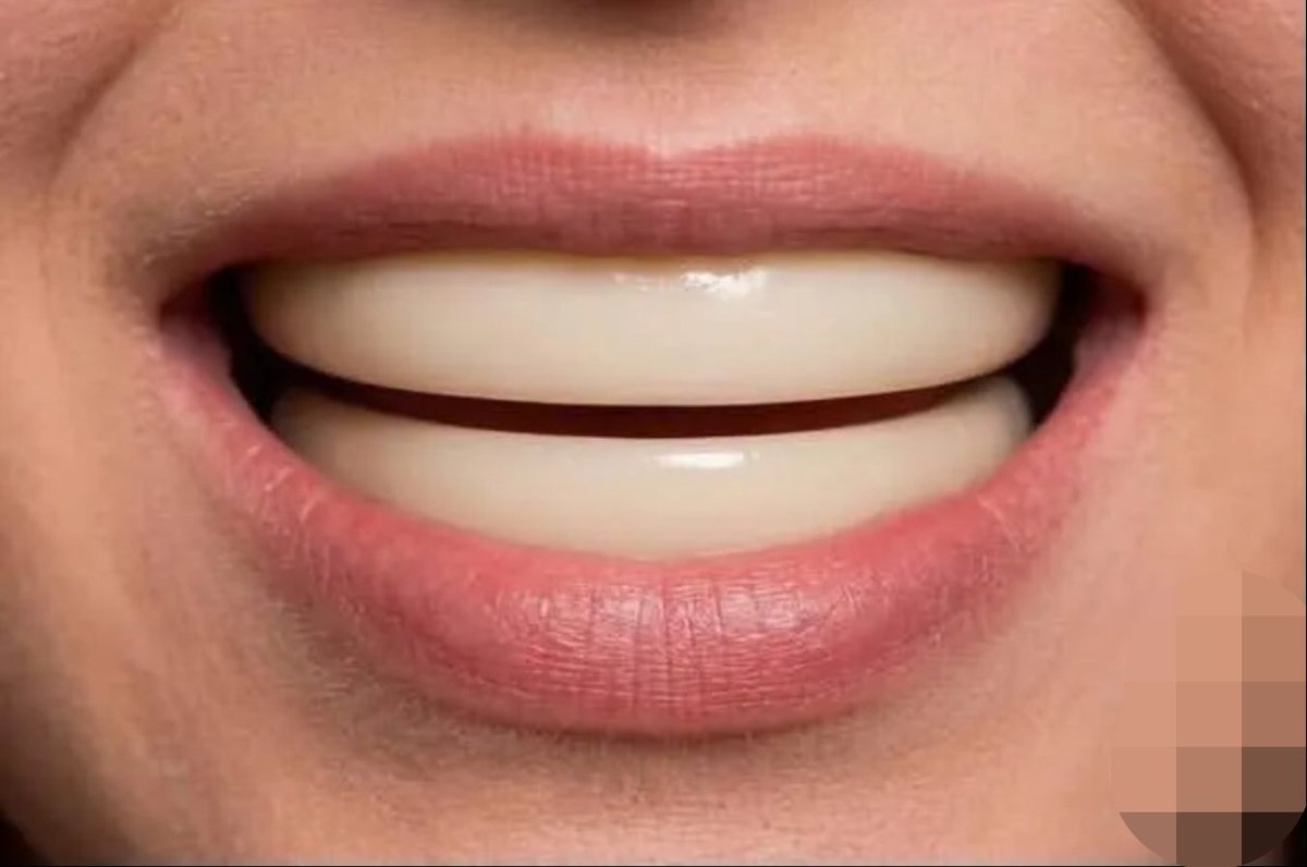wnwn34343's tweet photo. Why exactly do we need 32 separate teeth? If we could just have one single dental plate on the top and one on the bottom, wouldn't that be easier to use and cleaner? https://t.co/QPCfL3zpz0